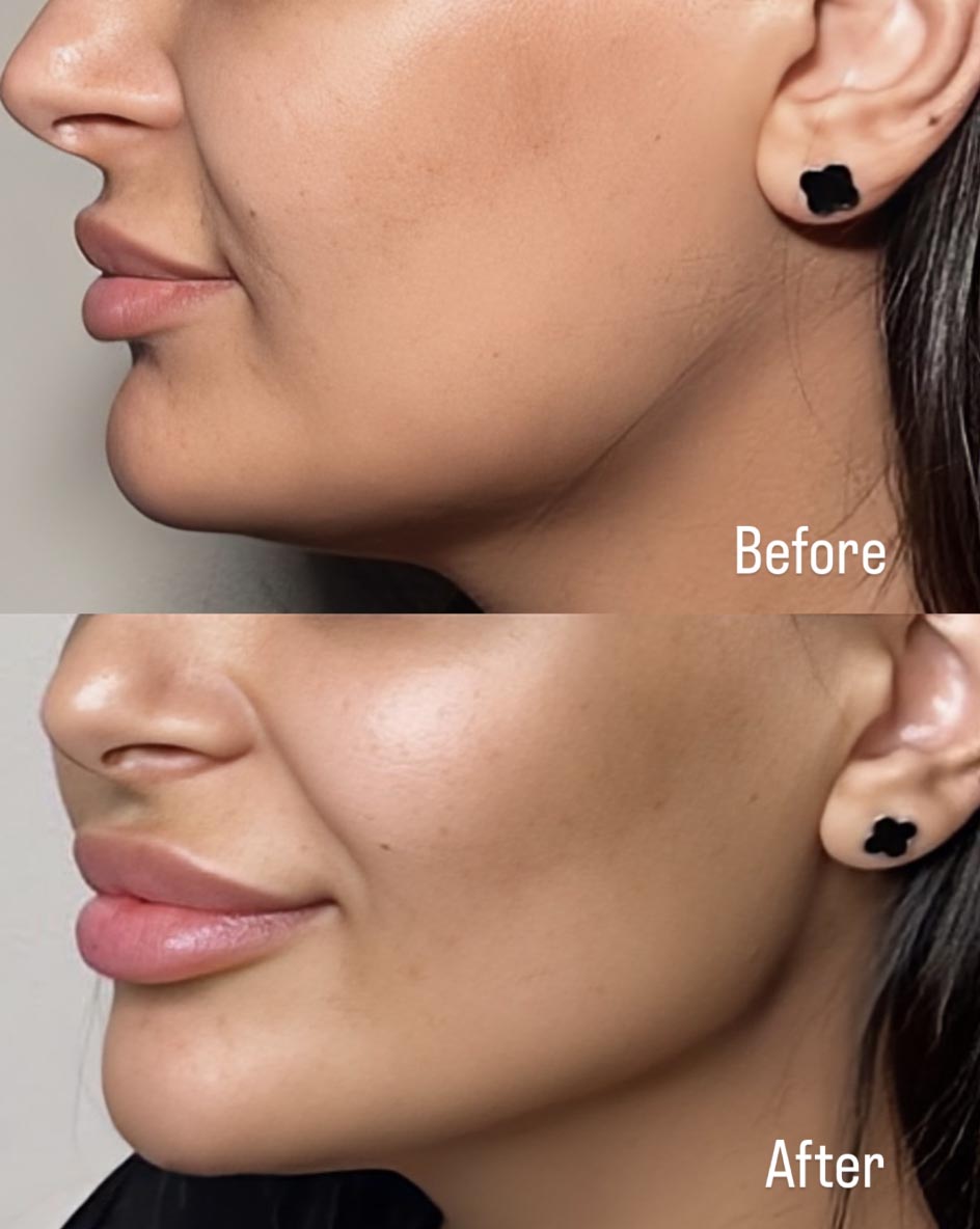 Before/After 1