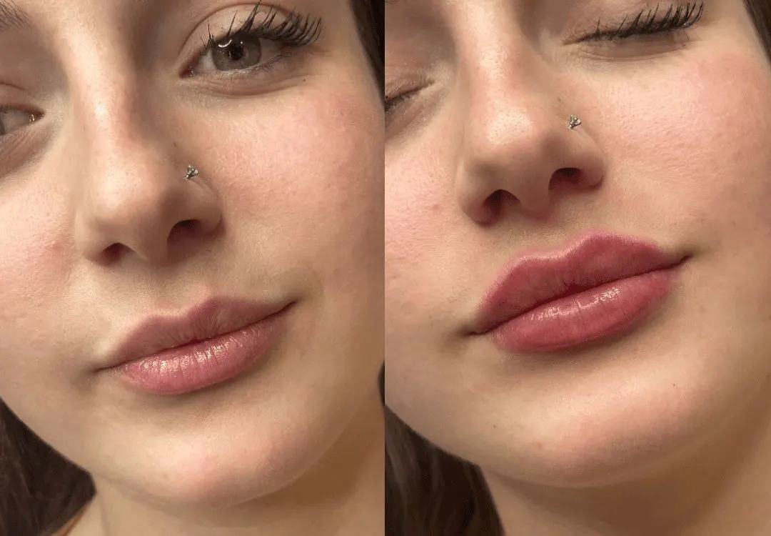 Before/After 3