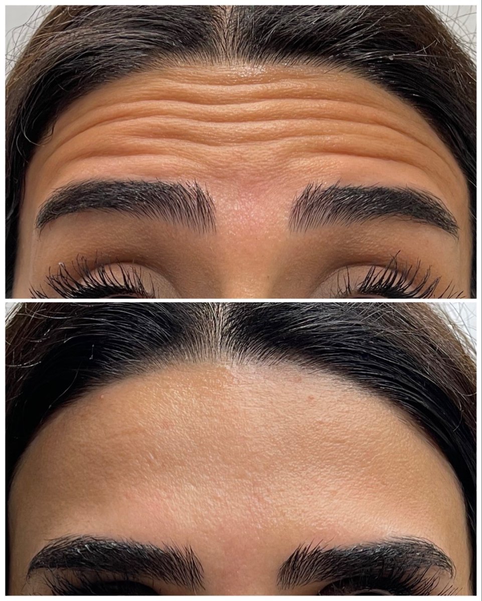 Before/After 4